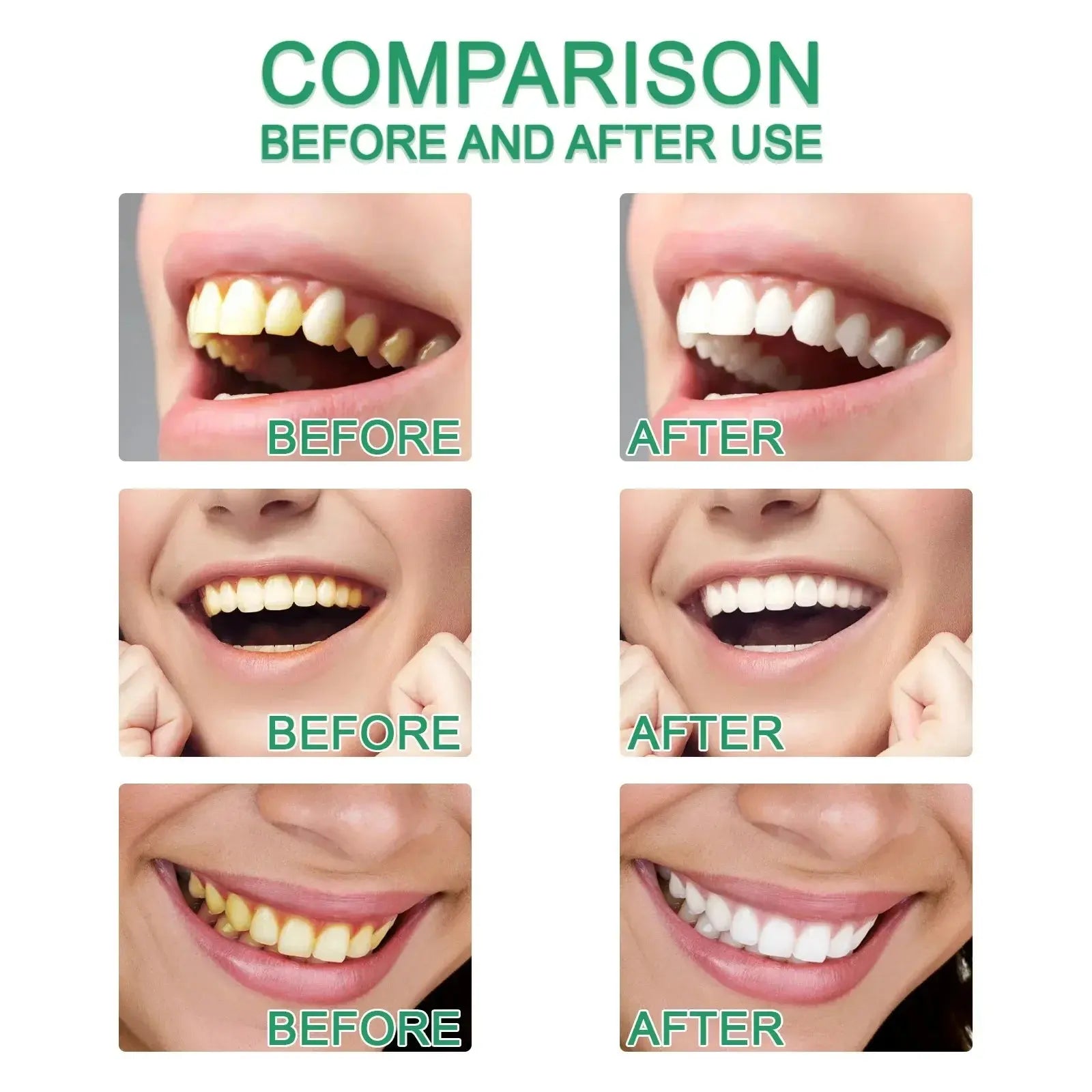 5 Days Teeth Whitening Toothpaste Remove Plaque Stains Powder Deep Cleaning Oral Hygiene Fresh Breath Brightening Tooth Care 50g - Suncollections