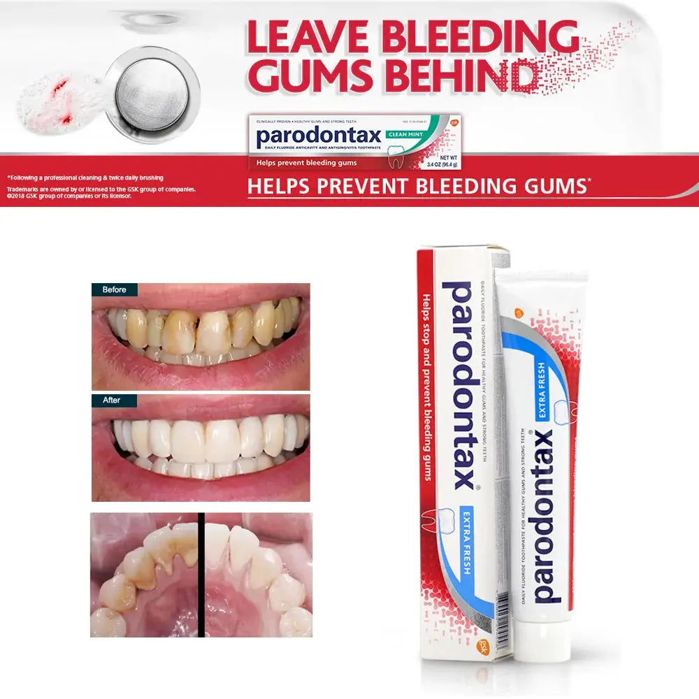 Parodontax Toothpaste Drops Strong Teeth Oral Care Products - Suncollections