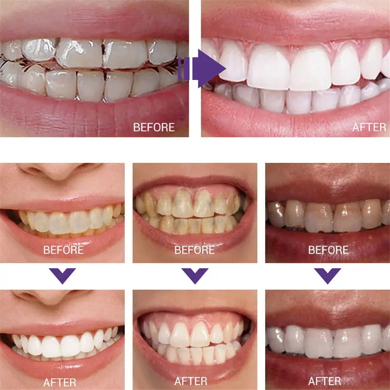 Teeth Cleansing Whitening Toothpaste Whiten Gel Whitener Bleach Removes Stains - Suncollections