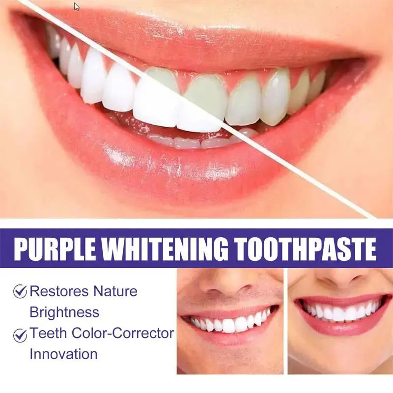 Teeth Cleansing Whitening Toothpaste Whiten Gel Whitener Bleach Removes Stains - Suncollections