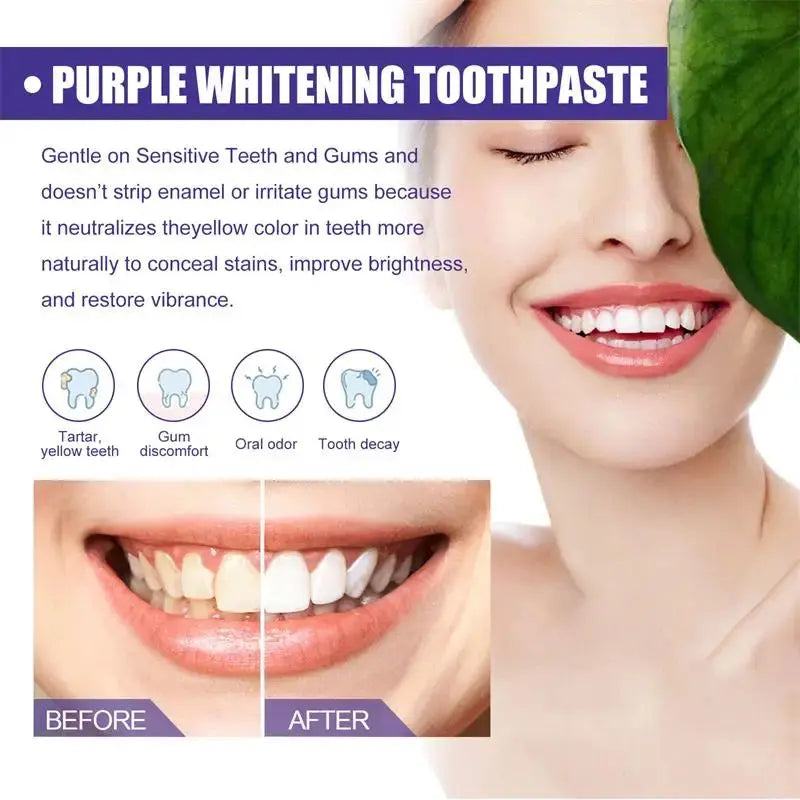 Teeth Cleansing Whitening Toothpaste Whiten Gel Whitener Bleach Removes Stains - Suncollections