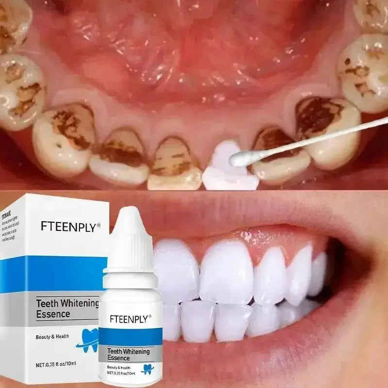 5 Days Teeth Whitening Toothpaste Remove Plaque Stains Powder Deep Cleaning Oral Hygiene Fresh Breath Brightening Tooth Care 50g - Suncollections