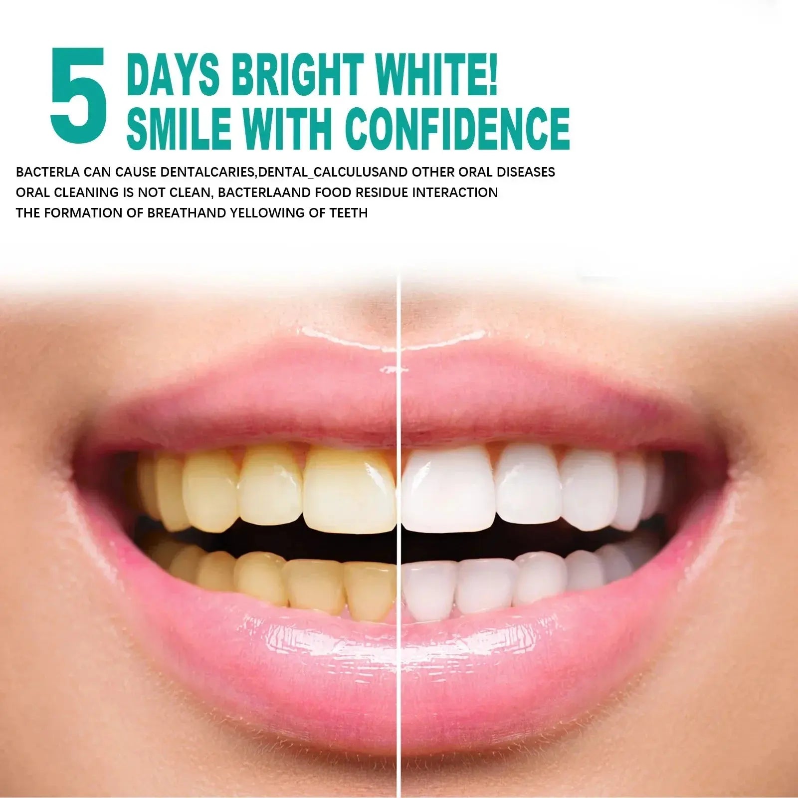 5 Days Teeth Whitening Toothpaste Remove Plaque Stains Powder Deep Cleaning Oral Hygiene Fresh Breath Brightening Tooth Care 50g - Suncollections