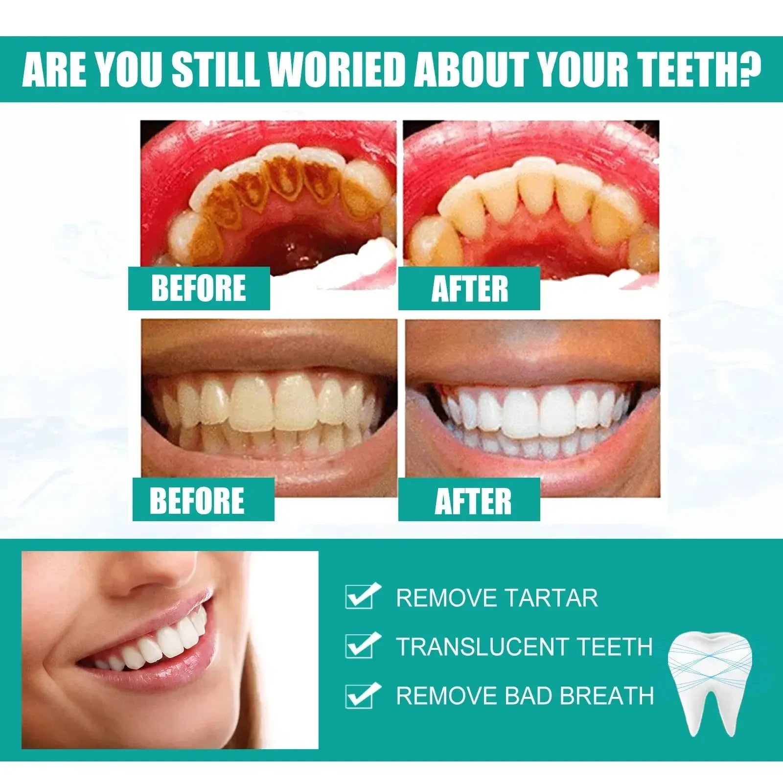 5 Days Teeth Whitening Toothpaste Remove Plaque Stains Powder Deep Cleaning Oral Hygiene Fresh Breath Brightening Tooth Care 50g - Suncollections