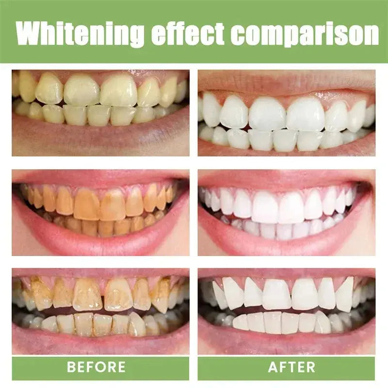 5 Days Teeth Whitening Toothpaste Remove Plaque Stains Powder Deep Cleaning Oral Hygiene Fresh Breath Brightening Tooth Care 50g - Suncollections