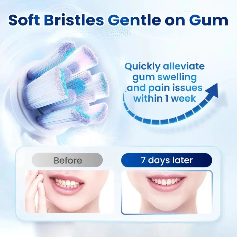 Oral-B iO Series 2 - Suncollections