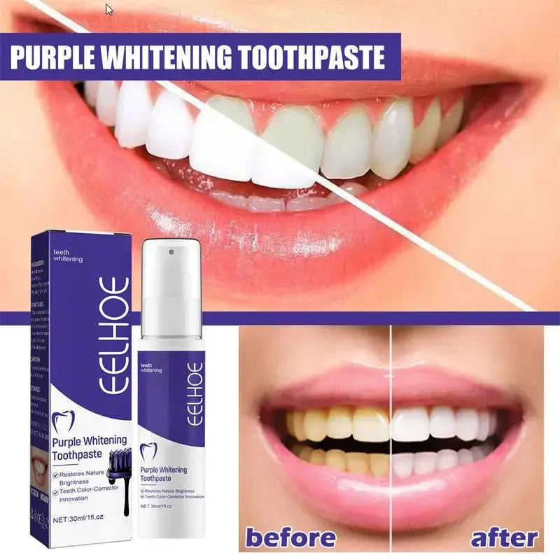 Teeth Cleansing Whitening Toothpaste Whiten Gel Whitener Bleach Removes Stains - Suncollections