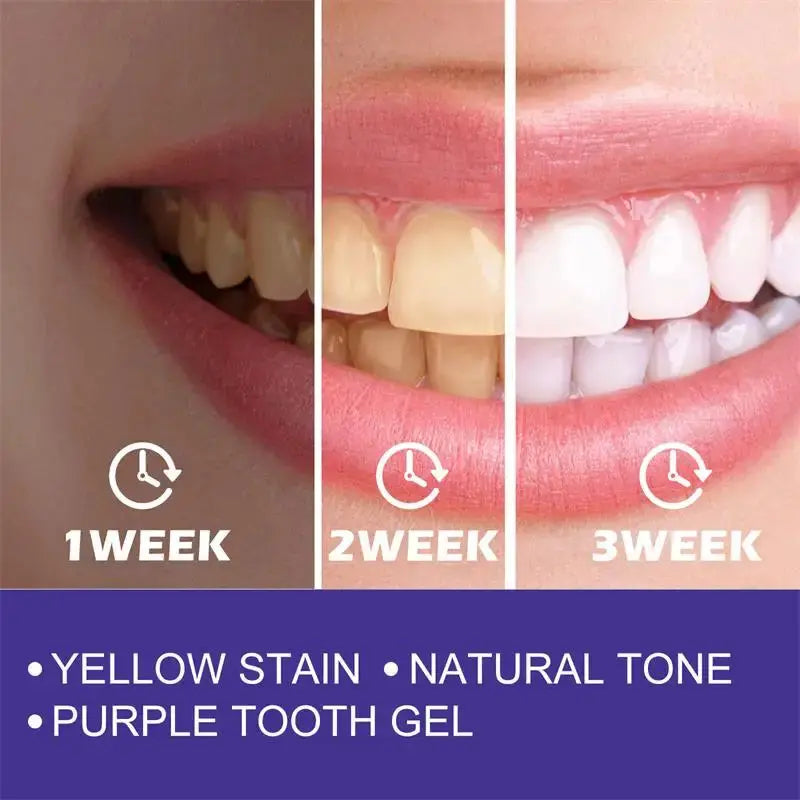 Teeth Cleansing Whitening Toothpaste Whiten Gel Whitener Bleach Removes Stains - Suncollections