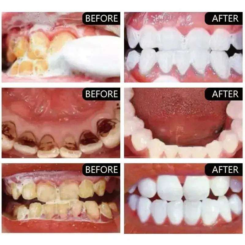 5 Days Teeth Whitening Toothpaste Remove Plaque Stains Powder Deep Cleaning Oral Hygiene Fresh Breath Brightening Tooth Care 50g - Suncollections