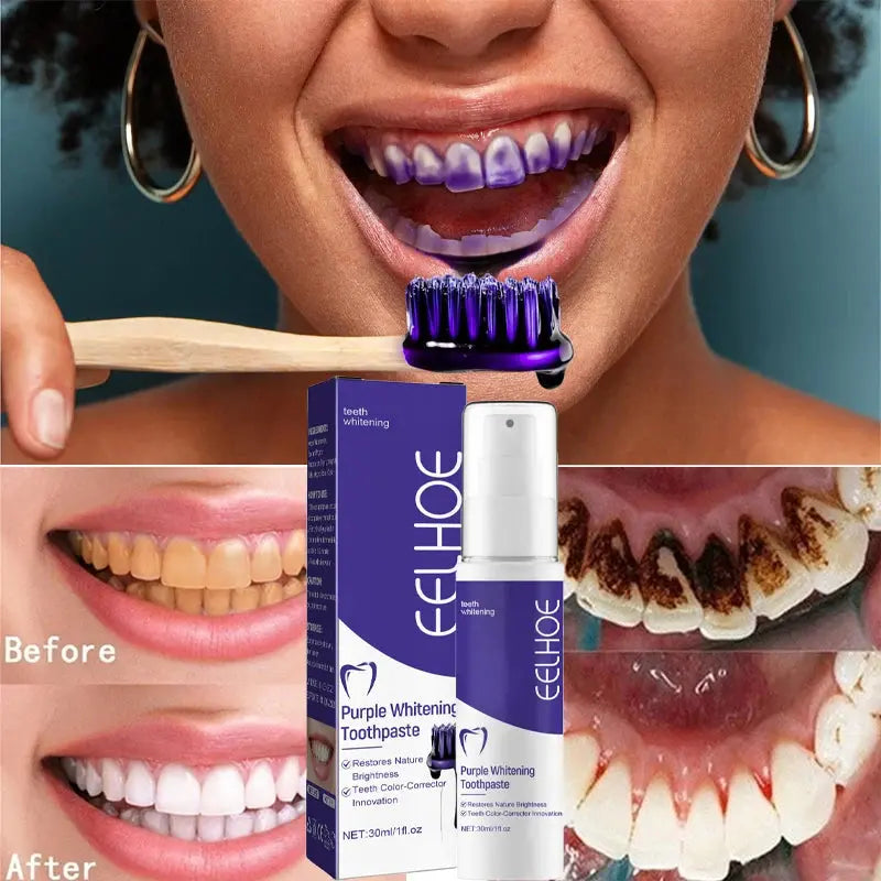Teeth Cleansing Whitening Toothpaste Whiten Gel Whitener Bleach Removes Stains - Suncollections