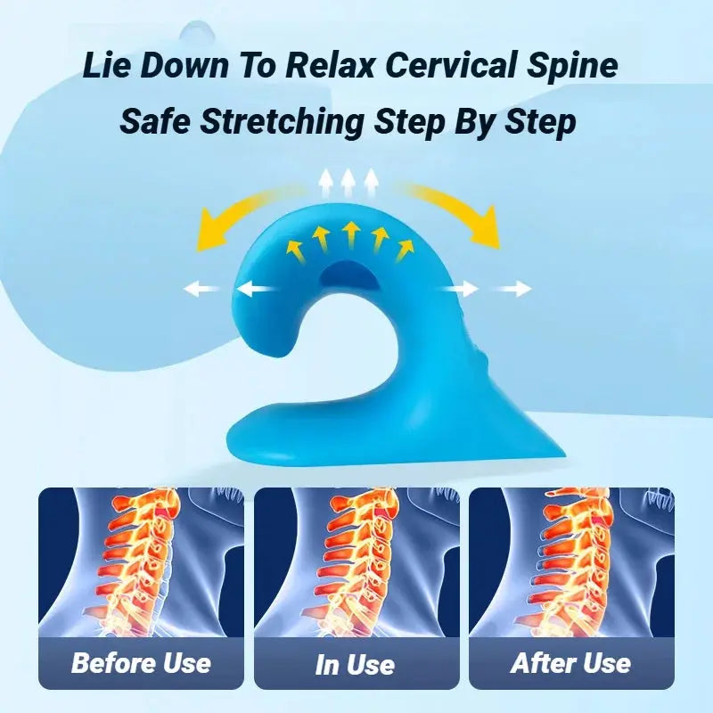 C-Type Neck Shoulder Relaxer - Suncollections