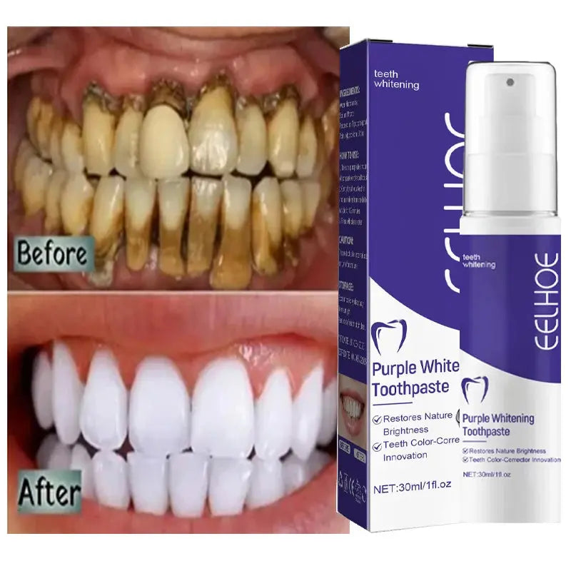 Teeth Cleansing Whitening Toothpaste Whiten Gel Whitener Bleach Removes Stains - Suncollections