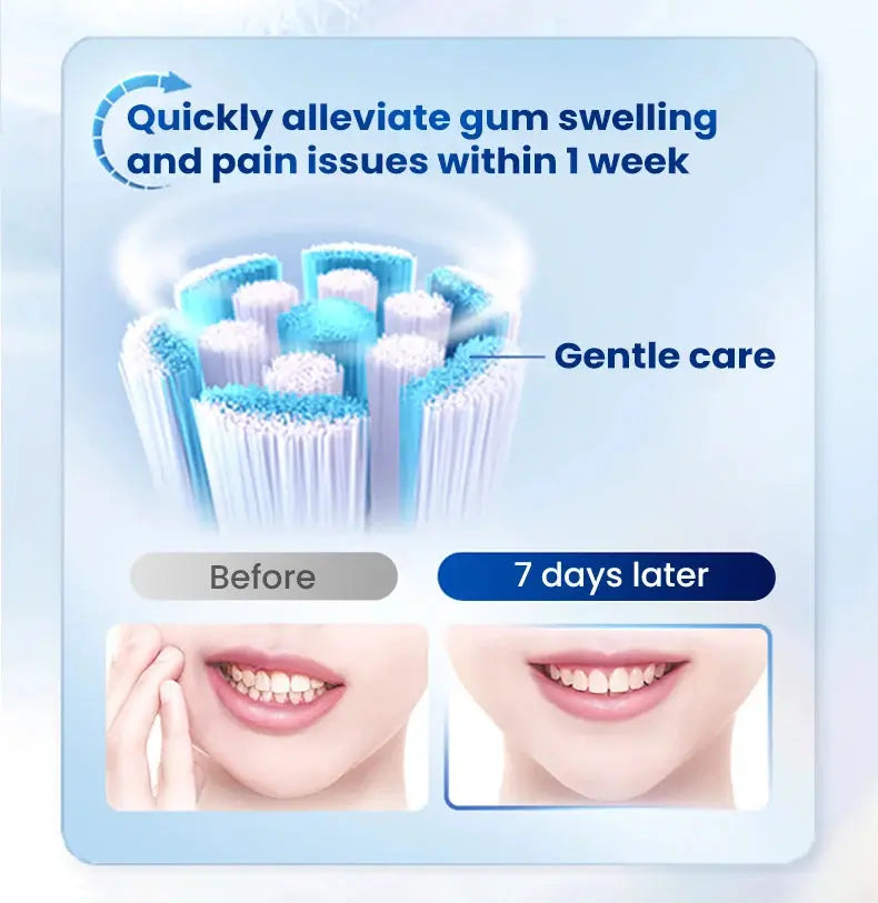 Oral-B iO Series 2 - Suncollections