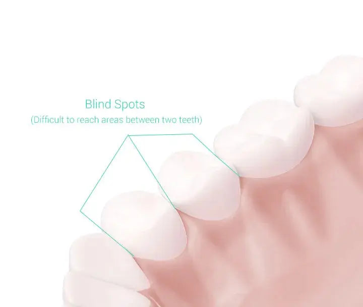 XIAOMI MIJIA T300 Electric Toothbrush - Suncollections