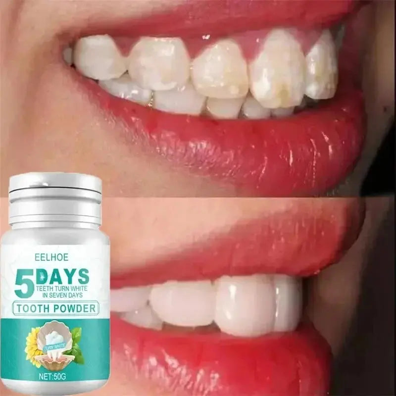 5 Days Teeth Whitening Toothpaste Remove Plaque Stains Powder Deep Cleaning Oral Hygiene Fresh Breath Brightening Tooth Care 50g - Suncollections
