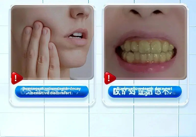 Baili Giant 99.8% High-purity Hydroxyapatite Toothpaste For Removing Bad Breath Whitening - Suncollections